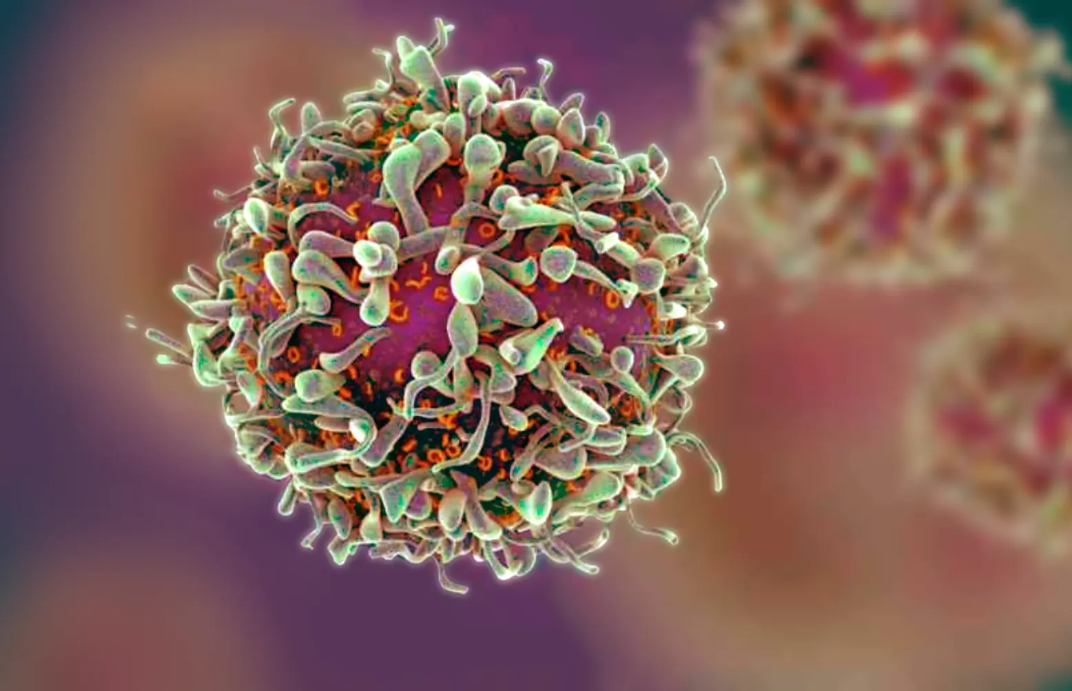 Myeloproliferative Neoplasms (MPNs) & Graft-Versus-Host Disease (GVHD)