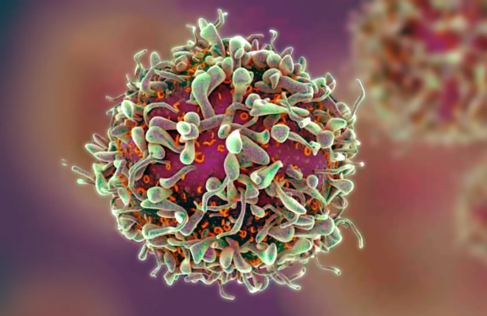 Myeloproliferative Neoplasms (MPNs) & Graft-Versus-Host Disease (GVHD)